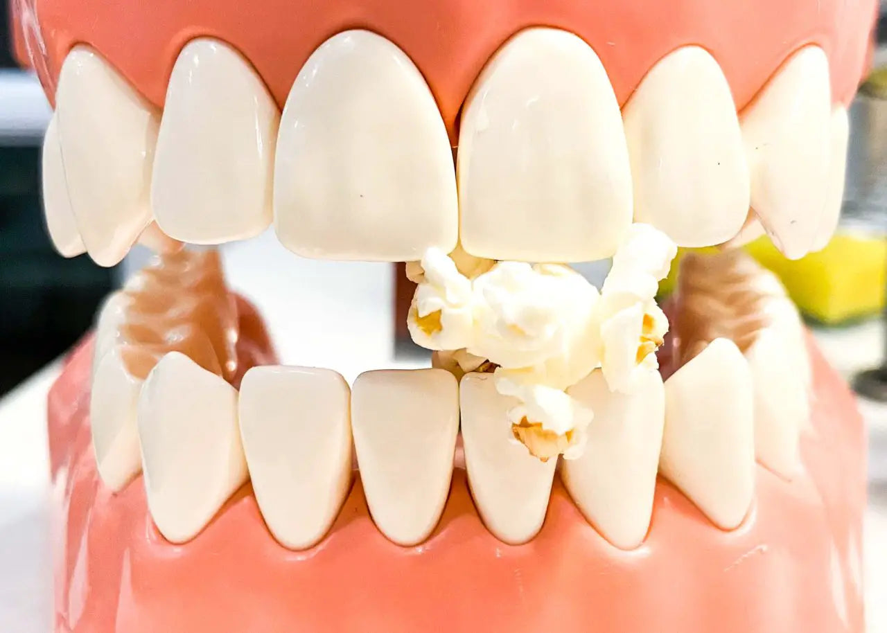 How to Get Popcorn Kernel Out of Gums